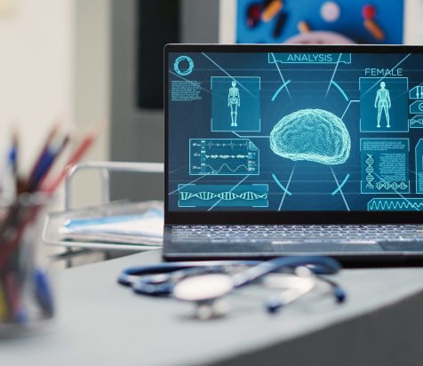 Laptop with human brain scan on desk